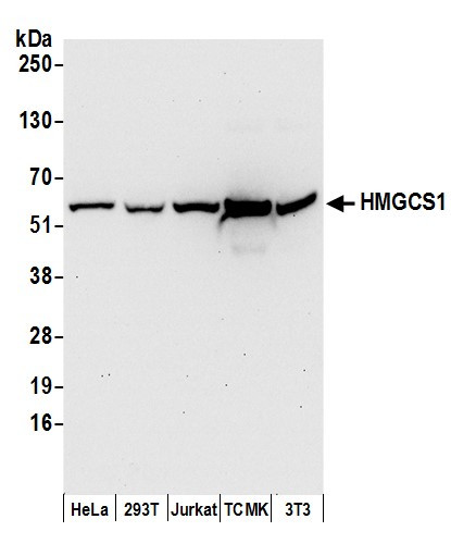 HMGCS1 Antibody in Western Blot (WB)