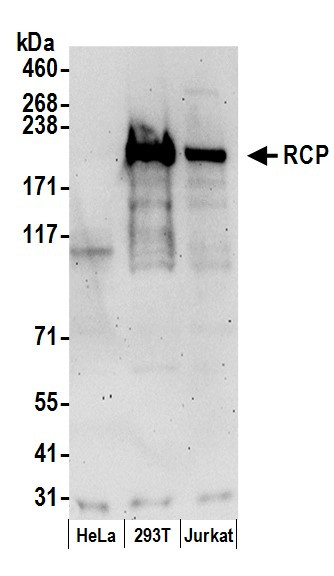RCP Antibody in Western Blot (WB)