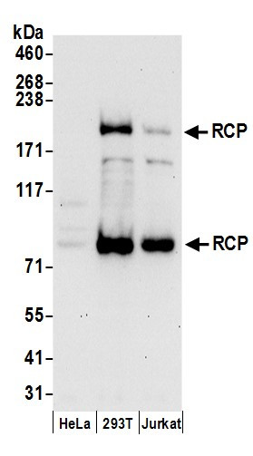 RCP Antibody in Western Blot (WB)