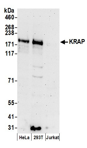 KRAP Antibody in Western Blot (WB)