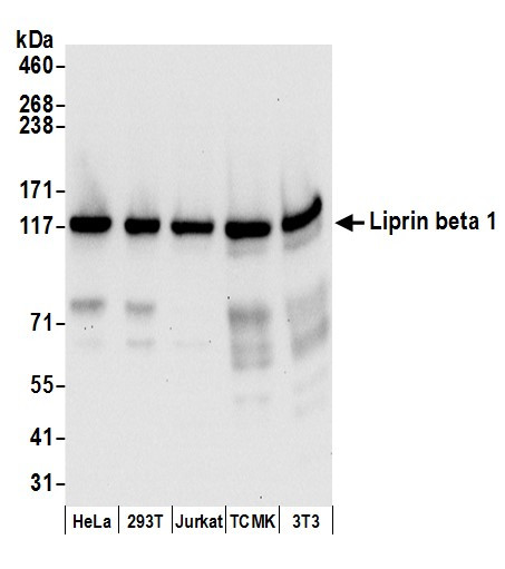 Liprin beta 1 Antibody in Western Blot (WB)