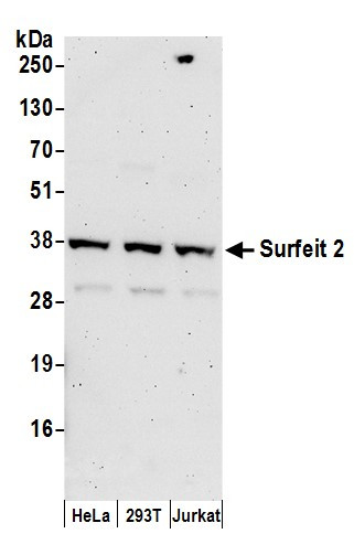 Surfeit 2 Antibody in Western Blot (WB)