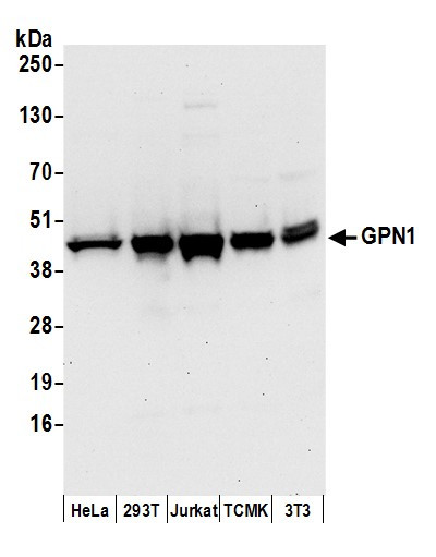 GPN1 Antibody in Western Blot (WB)