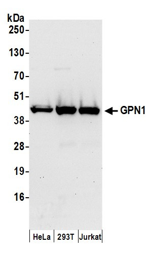 GPN1 Antibody in Western Blot (WB)