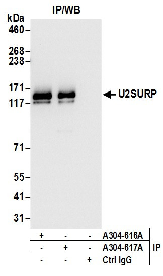 U2SURP Antibody in Immunoprecipitation (IP)