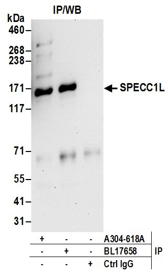 SPECC1L Antibody in Immunoprecipitation (IP)