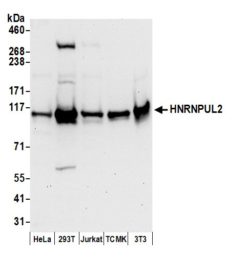 HNRNPUL2 Antibody in Western Blot (WB)