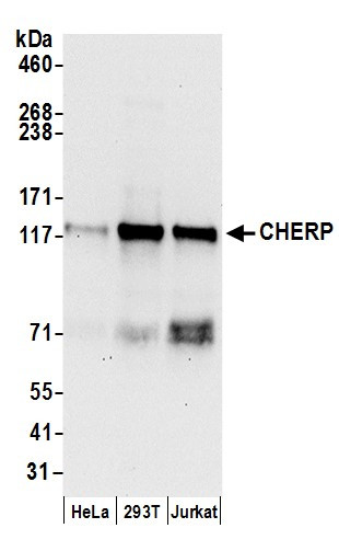CHERP Antibody in Western Blot (WB)