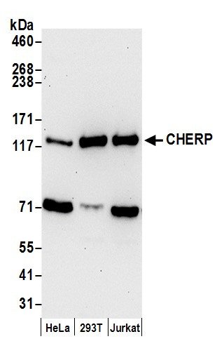 CHERP Antibody in Western Blot (WB)