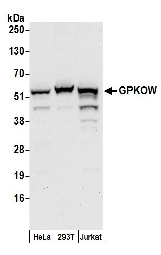GPKOW Antibody in Western Blot (WB)