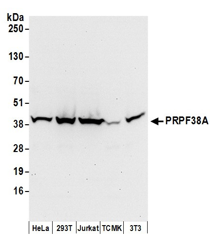 PRPF38A Antibody in Western Blot (WB)