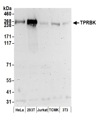 TPRBK Antibody in Western Blot (WB)