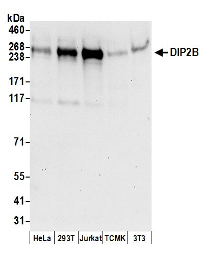 DIP2B Antibody in Western Blot (WB)
