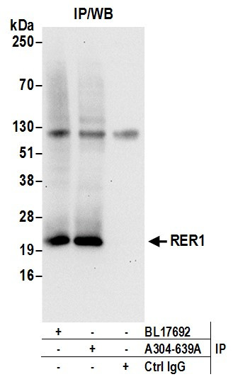 RER1 Antibody in Immunoprecipitation (IP)