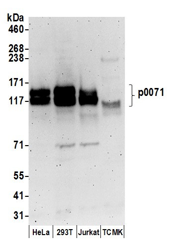 p0071 Antibody in Western Blot (WB)