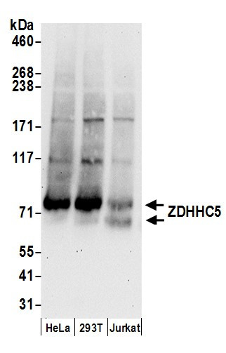 ZDHHC5 Antibody in Western Blot (WB)