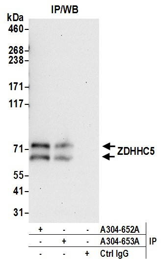 ZDHHC5 Antibody in Immunoprecipitation (IP)
