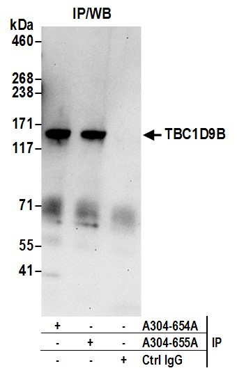 TBC1D9B Antibody in Immunoprecipitation (IP)