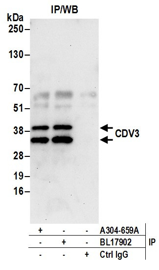 CDV3 Antibody in Immunoprecipitation (IP)