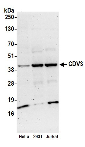 CDV3 Antibody in Western Blot (WB)