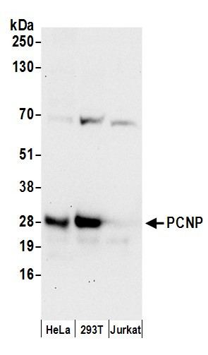 PCNP Antibody in Western Blot (WB)