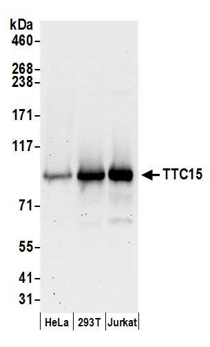 TTC15 Antibody in Western Blot (WB)