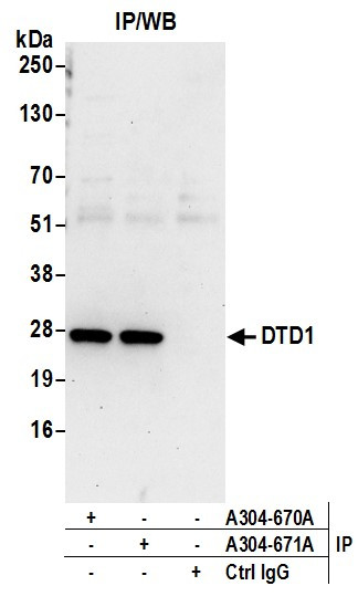 DTD1 Antibody in Immunoprecipitation (IP)