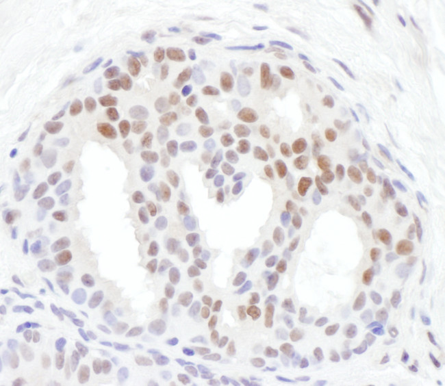 Phospho-Chk1 (Ser317) Antibody in Immunohistochemistry (Paraffin) (IHC (P))