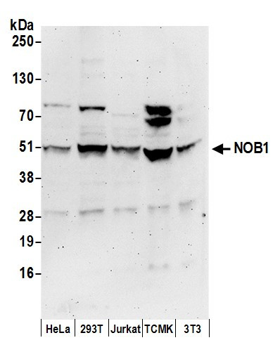 NOB1 Antibody in Western Blot (WB)