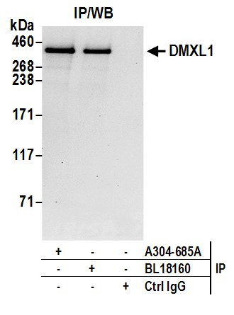 DMXL1 Antibody in Immunoprecipitation (IP)