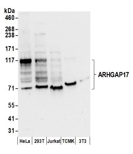 ARHGAP17 Antibody in Western Blot (WB)