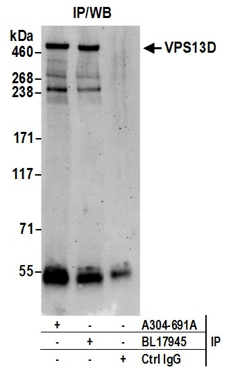 VPS13D Antibody in Immunoprecipitation (IP)