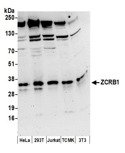ZCRB1 Antibody in Western Blot (WB)