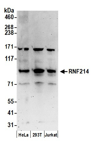 RNF214 Antibody in Western Blot (WB)