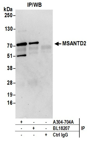 MSANTD2 Antibody in Immunoprecipitation (IP)
