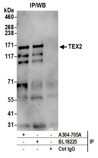 TEX2 Antibody in Immunoprecipitation (IP)