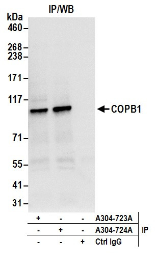 COPB1 Antibody in Immunoprecipitation (IP)