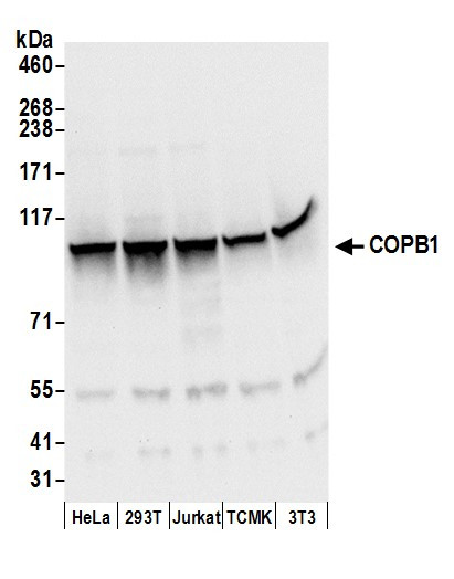COPB1 Antibody in Western Blot (WB)