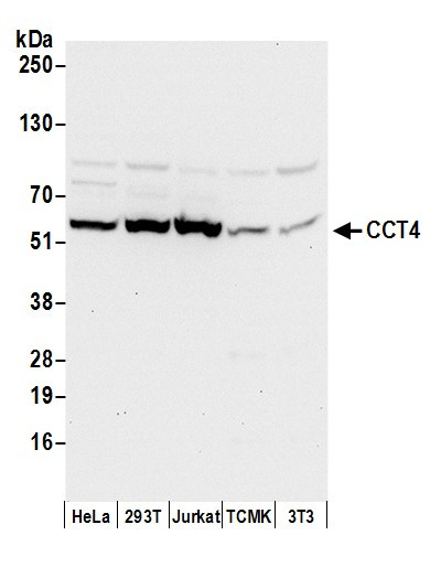 CCT4 Antibody in Western Blot (WB)