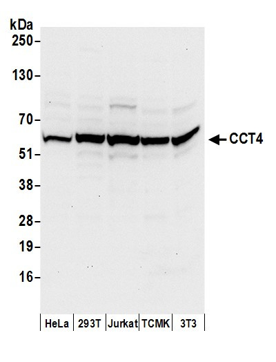 CCT4 Antibody in Western Blot (WB)