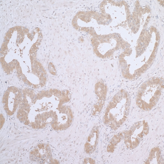 CCT7 Antibody in Immunohistochemistry (Paraffin) (IHC (P))