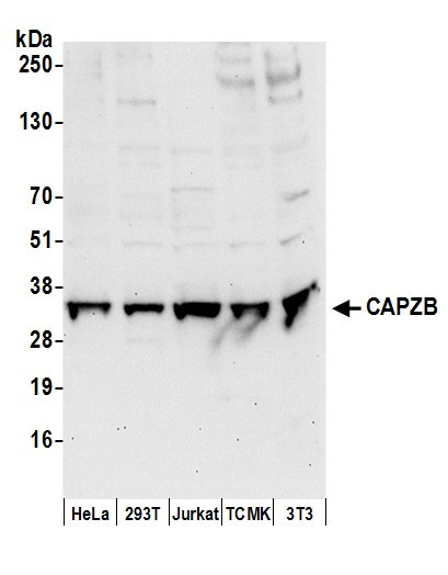 CAPZB Antibody in Western Blot (WB)