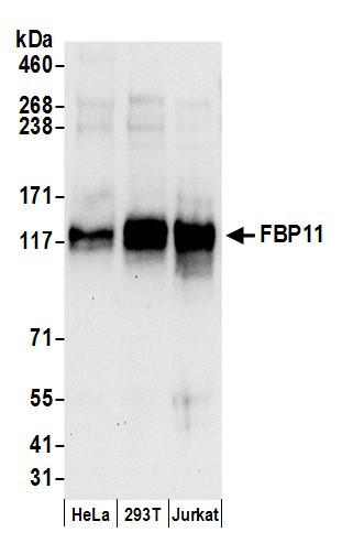 FBP11 Antibody in Western Blot (WB)