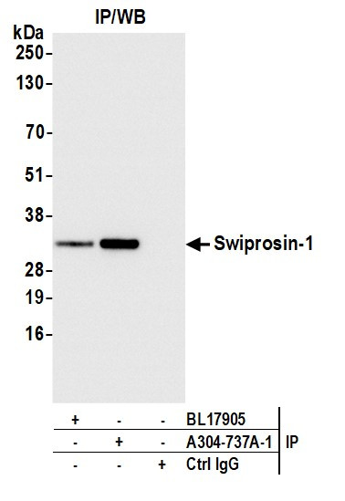 Swiprosin-1 Antibody in Immunoprecipitation (IP)