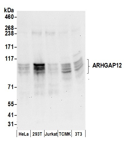 ARHGAP12 Antibody in Western Blot (WB)