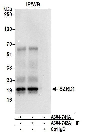 SZRD1 Antibody in Immunoprecipitation (IP)