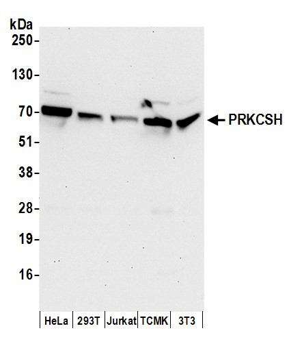 PRKCSH Antibody in Western Blot (WB)