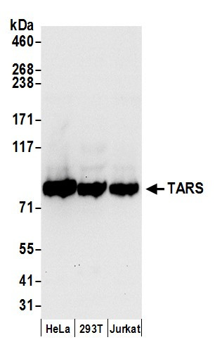 TARS Antibody in Western Blot (WB)