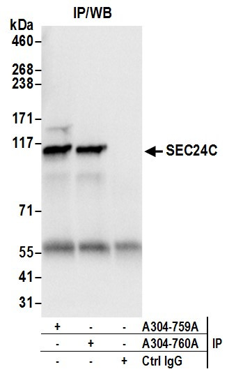 SEC24C Antibody in Immunoprecipitation (IP)