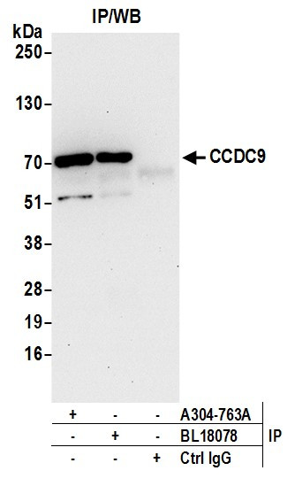 CCDC9 Antibody in Immunoprecipitation (IP)
